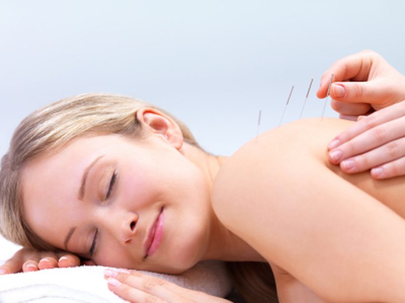 Acupuncture back treatment